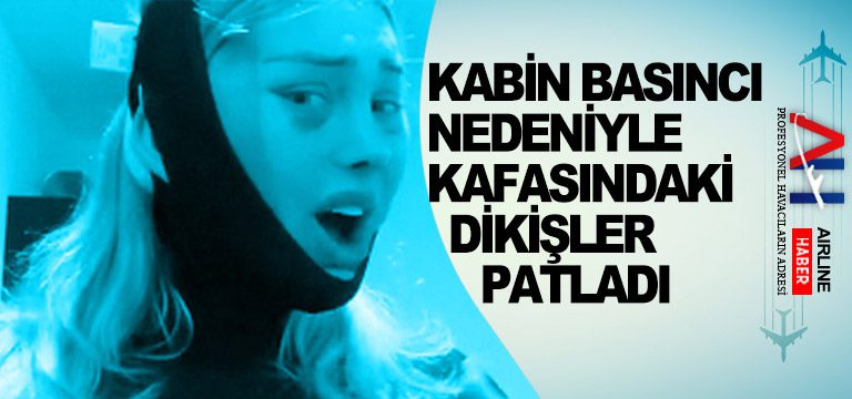 kabin-basıncı